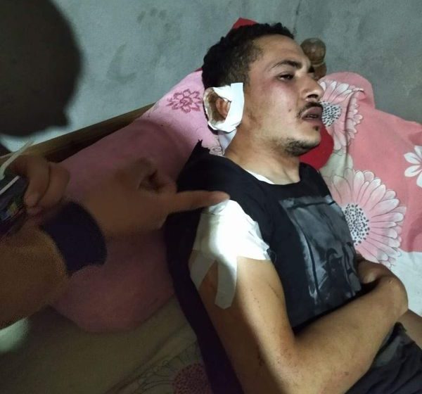  مزارع يعتدي على آخر بسبب رفضه بيع مزرعته له ببلبيس