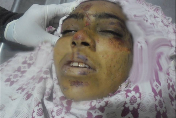  مصرع فتاة مجهولة الهوية دهسها قطار بأبو كبير