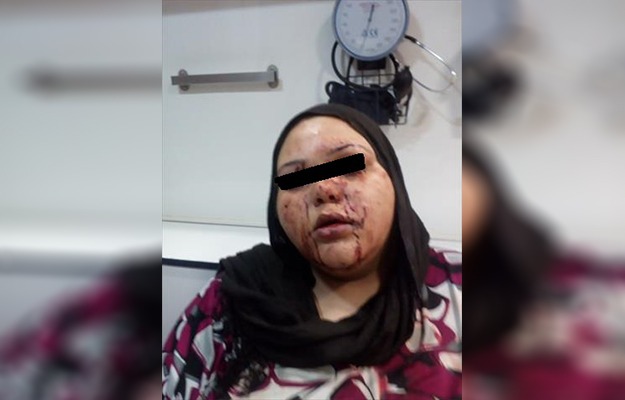  إصابة سيدة بخرطوش في عينيها بسبب الميراث في بلبيس
