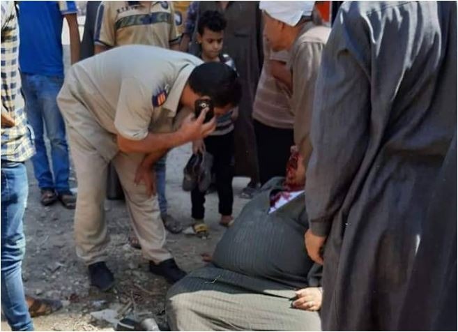  إصابة مسن بقطع جزء من وجهه بسبب بيارة مفتوحة في أبوكبير