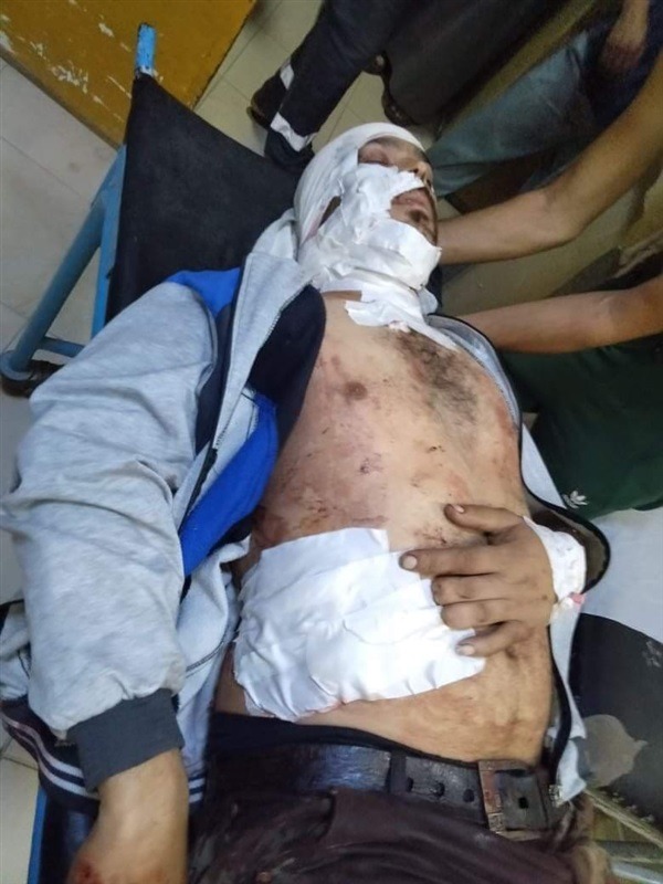  بسبب خلافات قديمة.. بلطجي يمزق جسد شابين بخنجر في أبوكبير