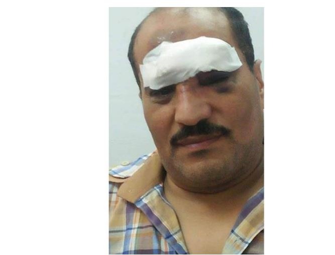  بسبب غياب الأمن.. إصابة سائق قطار بالحجارة في محطة “أبوكبير”