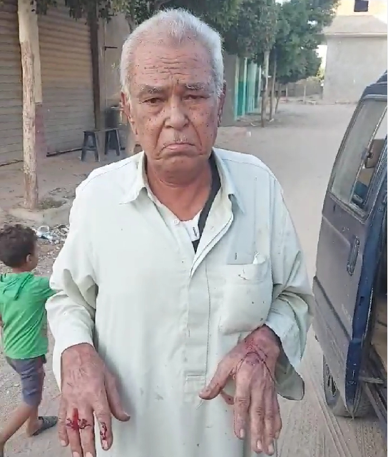  أحدث به جروح.. “مسجل” يعتدي على والده المسن ببلبيس