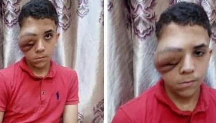 أسرة طفل من مشتول السوق تطالب “الصحة” بعلاجه