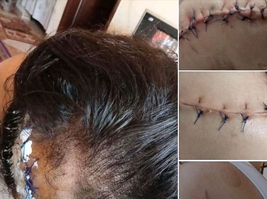 بلطجي يعتدي على سيدة وشقيقها بالسلاح الأبيض في أولاد صقر
