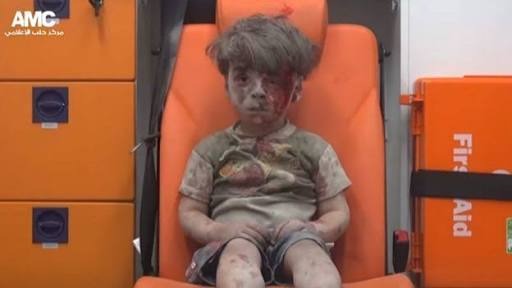  وفاة شقيق طفل حلب الذي صدمت صوره العالم متأثرًا بجراحه