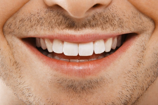  هذه الأغذية والمشروبات تؤثر على بياض أسنانك.. تجنبها